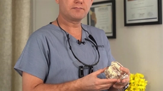 سن مناسب برای ایمپلنت دندان چیست؟