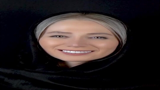 لمینیت سرامیکی دندان کلینیک دندانپزشکی آماریس پاسداران