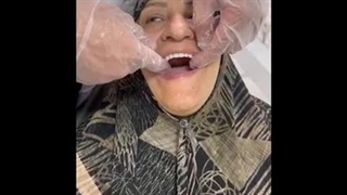 فیلم تجربه کاشت دندان مصنوعی