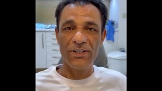 فیلم تجربه گذاشتن دندان مصنوعی کامل