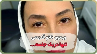 بهترین مرکز فیبروز ابرو در هفت حوض، مرکز آرایش دائم غزل زرگریان تزریق ژل