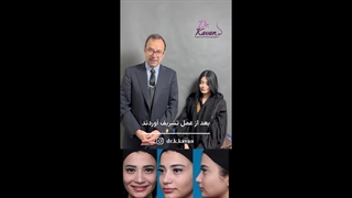 رضایت زیباجو از عمل زیبایی بینی