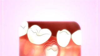 دکتر لیلی صدری-دندان پزشک کودکان ساری بلیچینگ