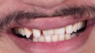 دکتر ایمان موصلی دندانپزشک بوشهر