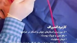 از بین بردن غبغب با دستگاه پزشکی Aphrodite