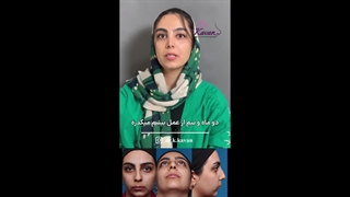 رضایت زیباجو از عمل زیبایی بینی