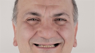 دکتر سامان کلانتری ایمپلنتولوژیست و متخصص پروتز دندانی