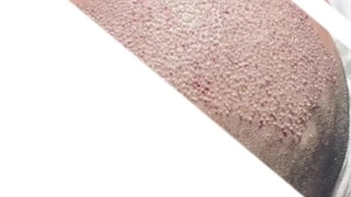 رحیمی زاده جراحی گوش