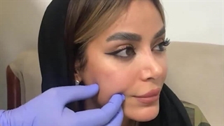 دکتر مرتضی جلالی فخر عصب‌کشی