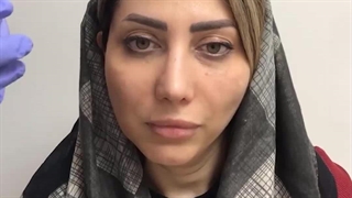 دکترمرتضی جلالی فخر هایفوتراپی