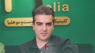 تغییرات جالب 5 ماه بعد از کاشت مو در کلینیک هلیا