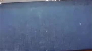 تزریق فیلر لب