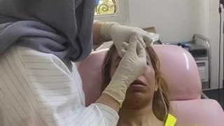 خانم دکتر برهانی در حال تزریق بوتاکس - آموزش تزریق بوتاکس با مدرک معتبر بین المللی از انگلستان و بیوکر اروپا