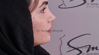 تجمیل الأنف فی طهران