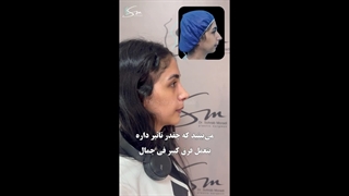 یه ژنیوپلاستی و عمل بینی چقدر میتونه چهرتو تغییر بده