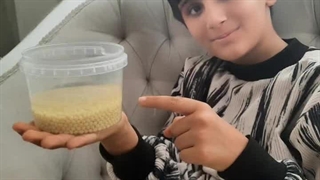 حلزون لرستان https://eitaa.com/HALAZONATS