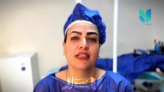 قبل و بعد کاشت ابرو کلینیک لاله