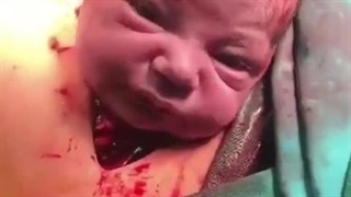 لحظه ای از شگفتی های دنیا از زایش و تولد