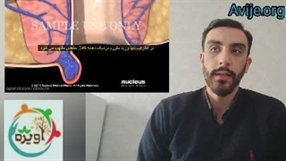 شرایط معافیت سربازی بواسیر