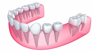 صفر تا صد ایمپلنت دندان
