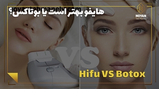 هایفو صورت بهتر است یا تزریق بوتاکس؟ چرا؟ اندودنتیکس