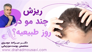 میدونی ریزش چند تار مو در روز طبیعی است؟