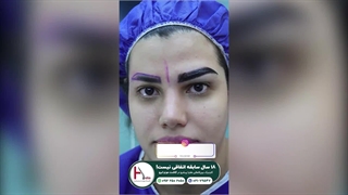 ابروهایی پرپشت و خوش فرم با جدیدترین روش‌ها