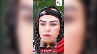 کاشت ابرو: هدیه ای زیبا به چهره شما