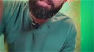 آتش بس نهائی شد روکش دندان