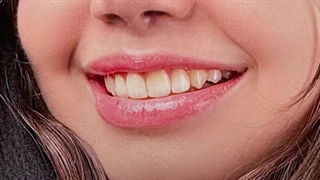 اصالت لبخند