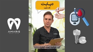 ایمپلنت دندان برای افراد دیابتی