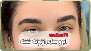 بهترین مرکز فیبروز ابرو دربهار شیراز