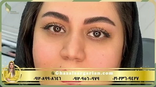 بهترین مرکز میکروبلیدینگ ابرو در تخت طاووس