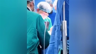 پرده بیهوشی