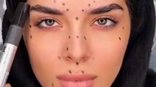 نقاط موثر تزریق بوتاکس برای داشتن چهره‌ای جوان‌تر و شاداب‌تر!