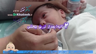 فیلم  بیحسی ختنه نوزاد آلمانی  استاد دکتر بلندی