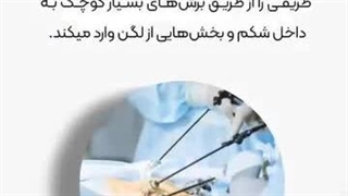 دکتر مینو باورساد تزریق بوتاکس