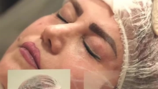 دکتر مجید فراهانی ابرسانی پوست