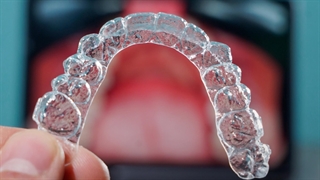 آیا ارتودنسی نامرئی تاثیر دارد ؟