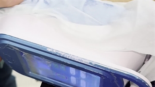 لاغری موضعی با دستگاه کرایولیپولیز در کلینیک مانا