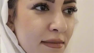 رضایت مراجعه کننده عزیز از کاشت ابروی طبیعی رنسانس