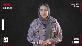 رضایت مراجع عزیز از انجام عمل بلفاروپلاستی در مشهد