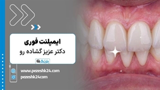 دکتر عزیز گشاده رو متخصص ایمپلنت فوری در تهران - پزشک 24