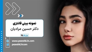 نمونه جراحی بینی عروسکی با دکتر حسین مرادیان در شیراز - پزشک 24