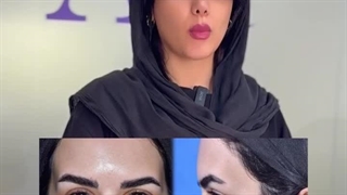 عمل بینی فوق العاده در تهران