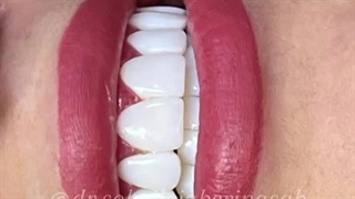 دکتر سهیل جابری نسب پالپوتومی