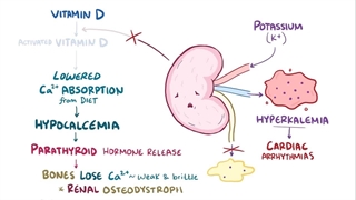 Chronic kidney disease