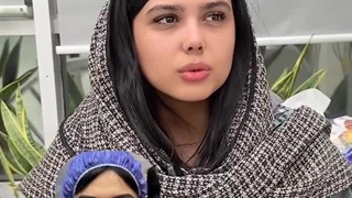 جراحی بینی با نوک افتاده واستخوانی در تهران