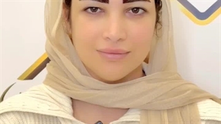 اصلاح فرم ابرو به روش سوپر نچرال