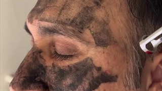 کلینیک زیبایی مه نگار-لیزر موهای زائد-لیزرتهرانپارس-کلینیک زیبایی تهرانپارس-بهترین کلینیک زیبایی تهرانپارس-لیزر شاتی-لیزر رولی